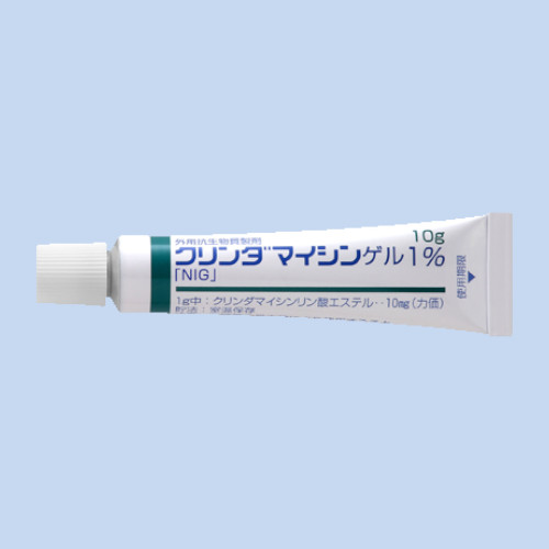 �N�����_�}�C�V���Q��1���uNIG�v