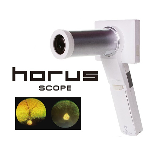 ホルス スコープ基本セット（眼底鏡レンズ添付）